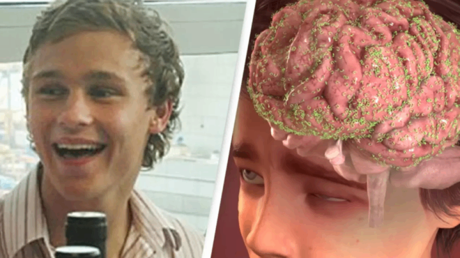 horrifying-simulation-shows-what-happened-to-teenager-after-he-was-dared-to-eat-live-slug-by-his-friends-47937